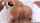 anal gape gaping