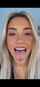 blonde tongue white