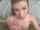 anne howe teen facial
