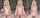 onlyfans tits teen