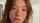 face freckles head