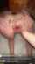 anal dildo gape